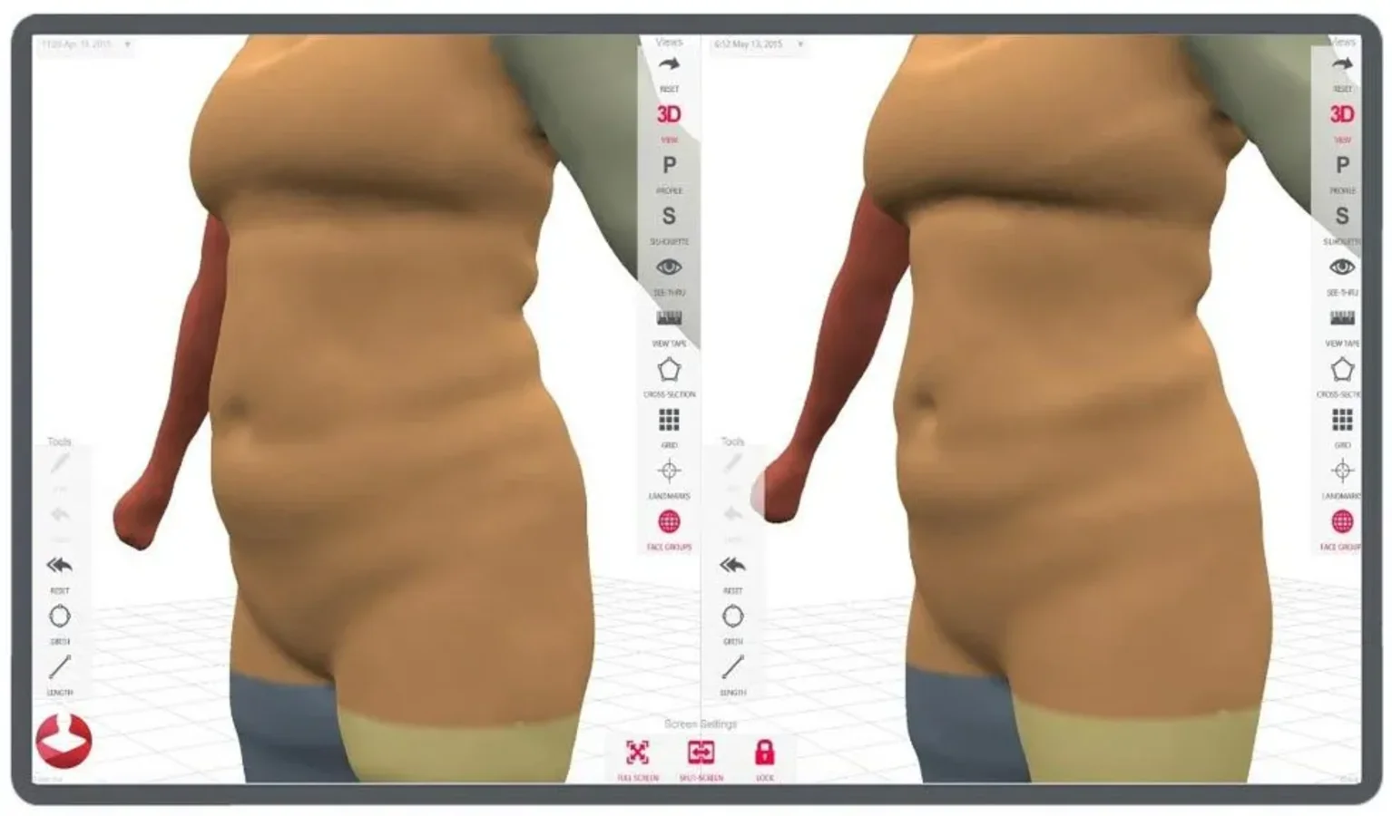 3d body scan melbourne